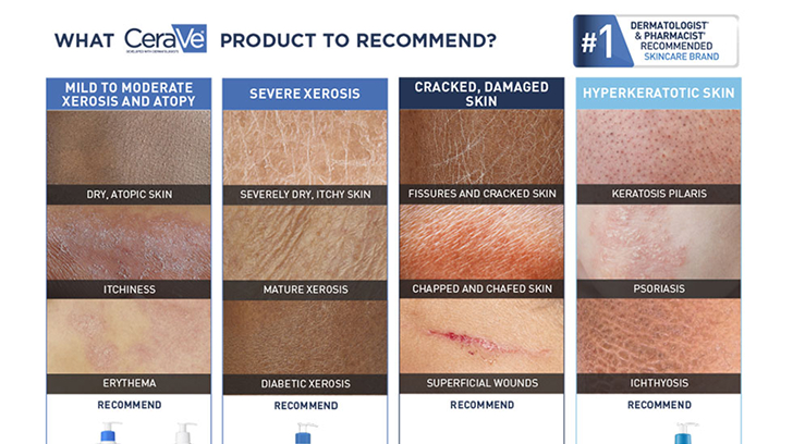 CeraVe product recommendation grid by severity of xerosis