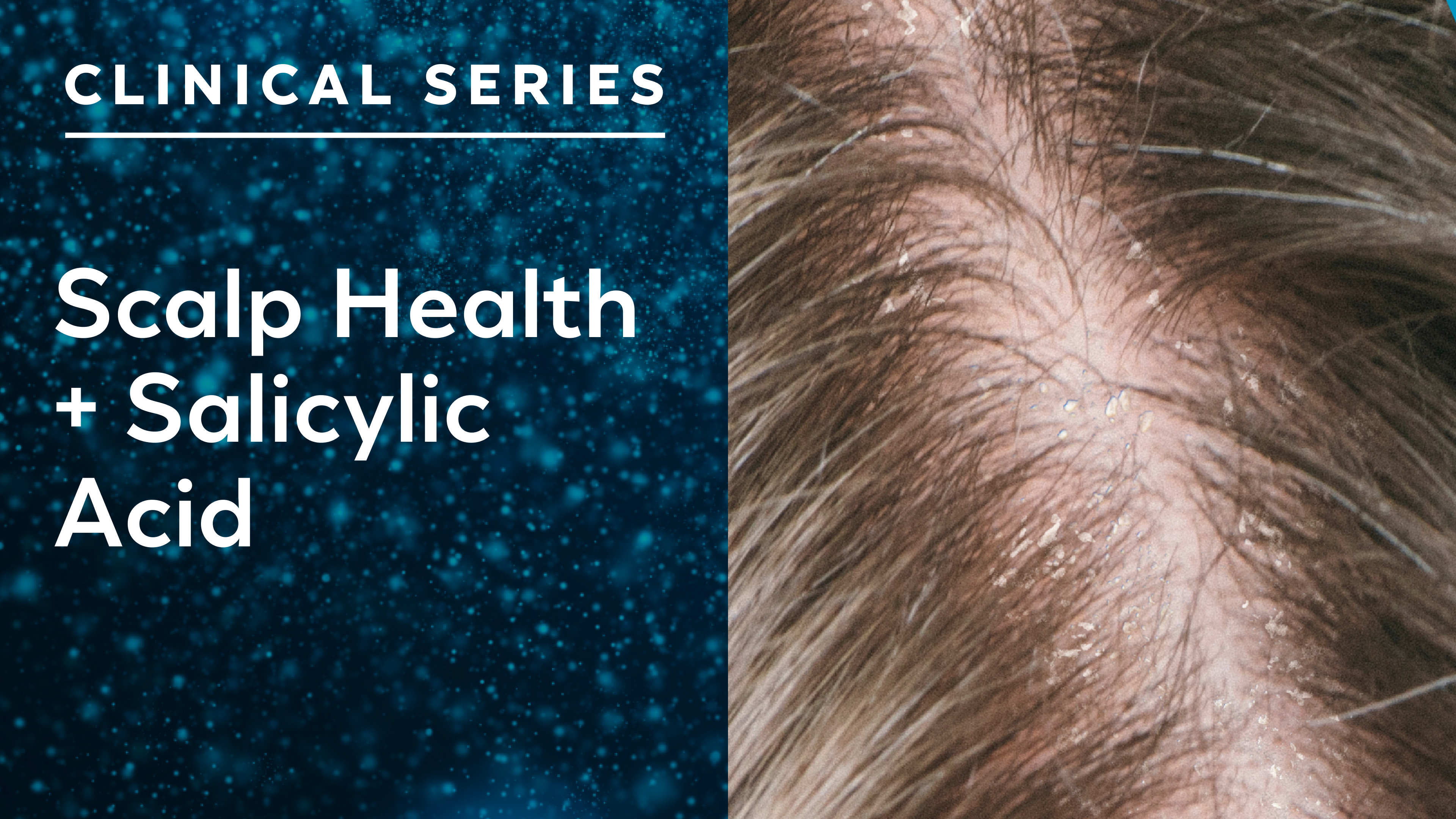 Clinical Series-Article